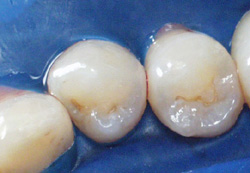 Microdentistry Image 1