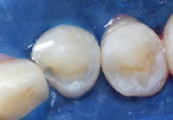 Microdentistry Image 2