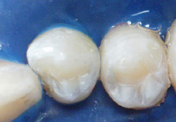 Microdentistry Image 3