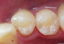 Microdentistry Image 4
