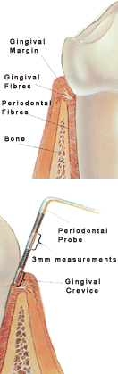 Periodontal Examination Image